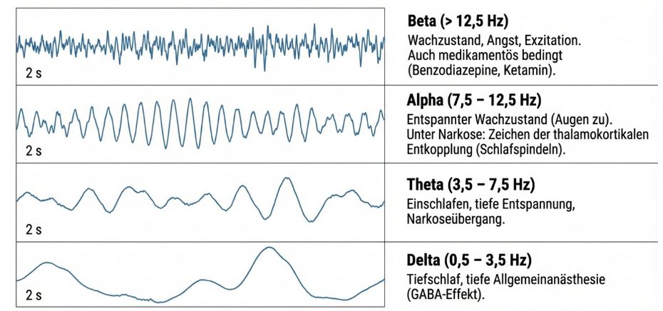 Vom Roh-EEG zum prozessierten EEG
