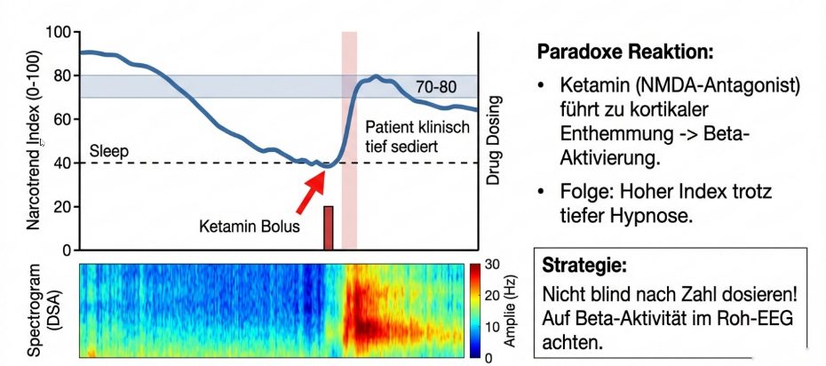 Paradoxe Reaktion: klinische Fallstudie