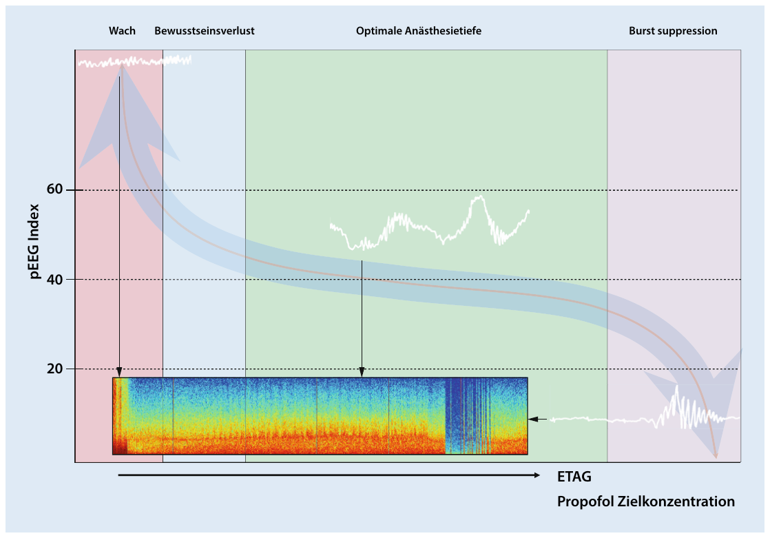 Sigmoidale Beziehung zwischen Anästhetikadosis und Indexwert mit den vier Zonen von der Wachheit über den steilen Übergang und die Erhaltung bis zur Suppression
