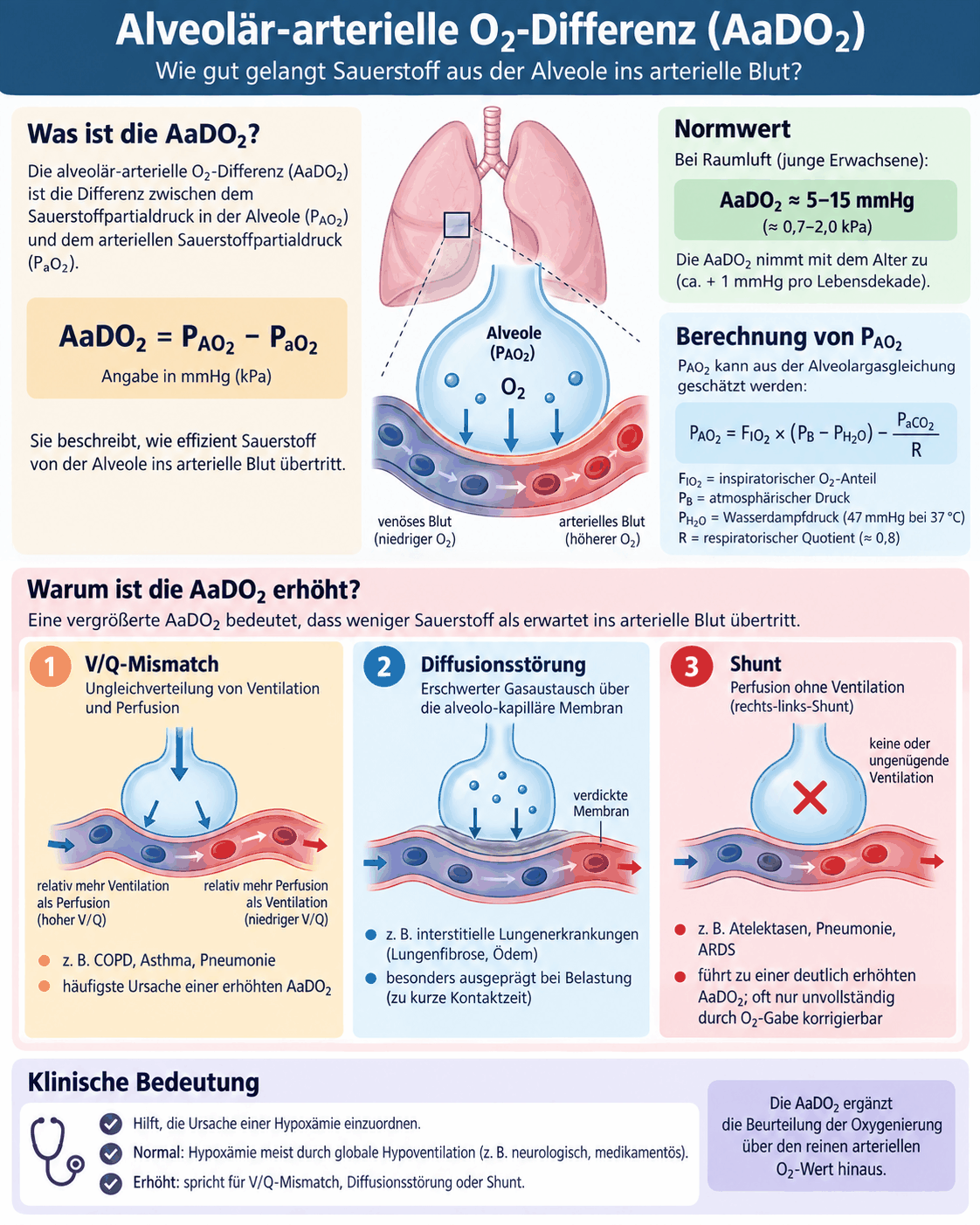 Übersicht zur alveolär-arteriellen Sauerstoffdifferenz mit Definition, Normwert bei Raumluft, Alveolargasgleichung mit ihren Größen und den drei Ursachen einer erhöhten Differenz: Ventilation-Perfusion-Ungleichgewicht, Diffusionsstörung und Shunt