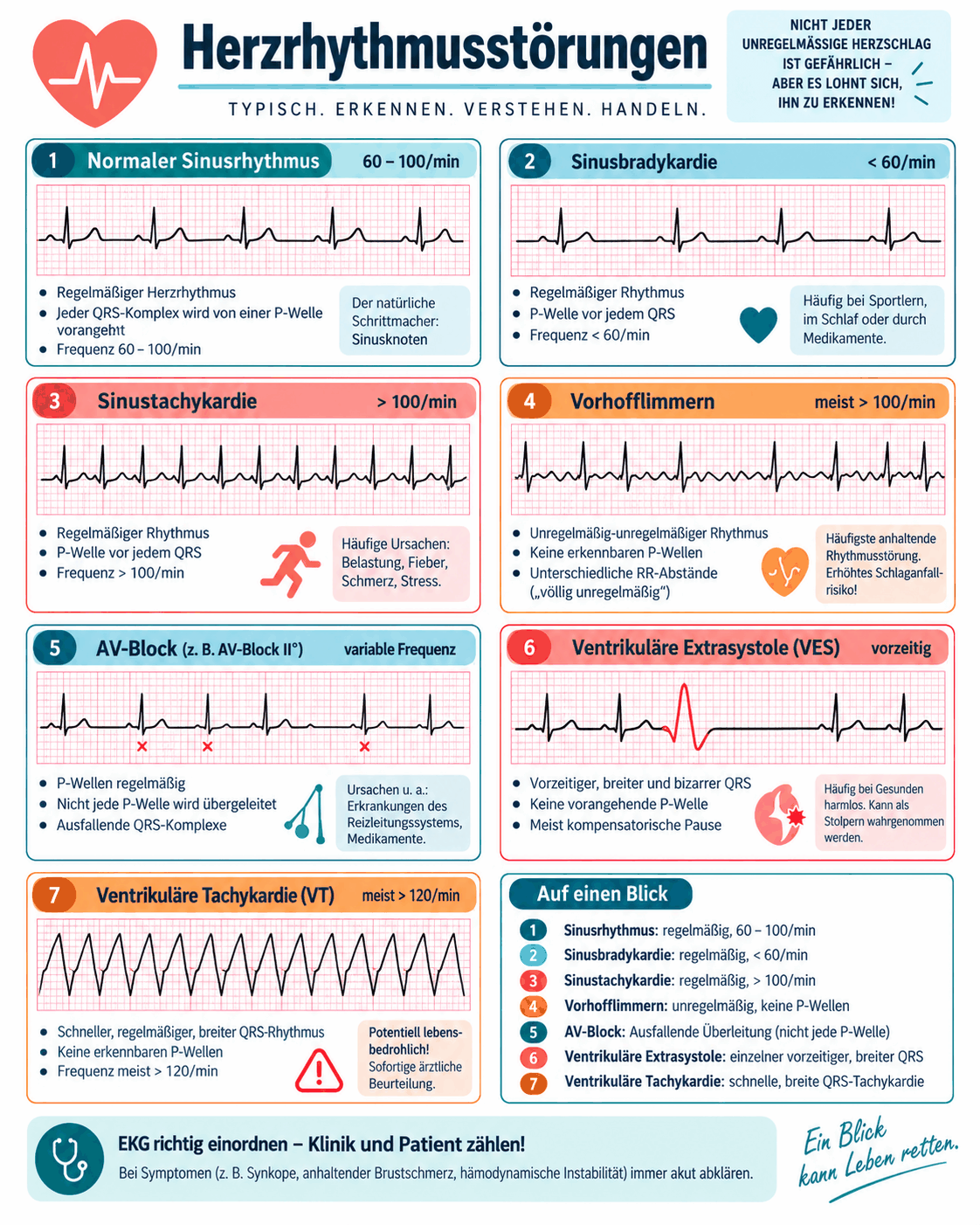 Übersicht der Herzrhythmusstörungen mit Beispielstreifen für normalen Sinusrhythmus, Sinusbradykardie, Sinustachykardie, Vorhofflimmern, AV-Block zweiten Grades, ventrikuläre Extrasystole und ventrikuläre Tachykardie mit Merkmalen und Ursachen