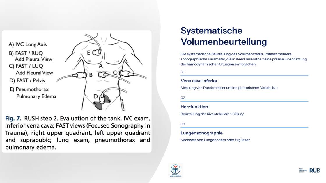 Folie 34: Systematische Volumenbeurteilung