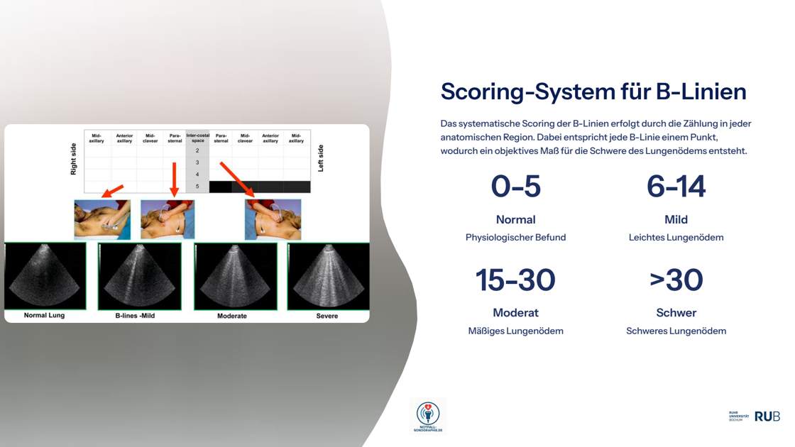 Folie 51: Scoring-System für B-Linien