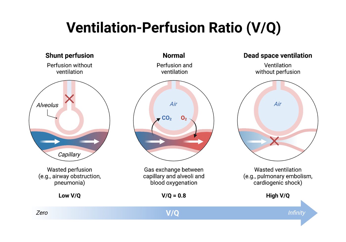 Ventilation und Perfusion: das V/Q-Verhältnis