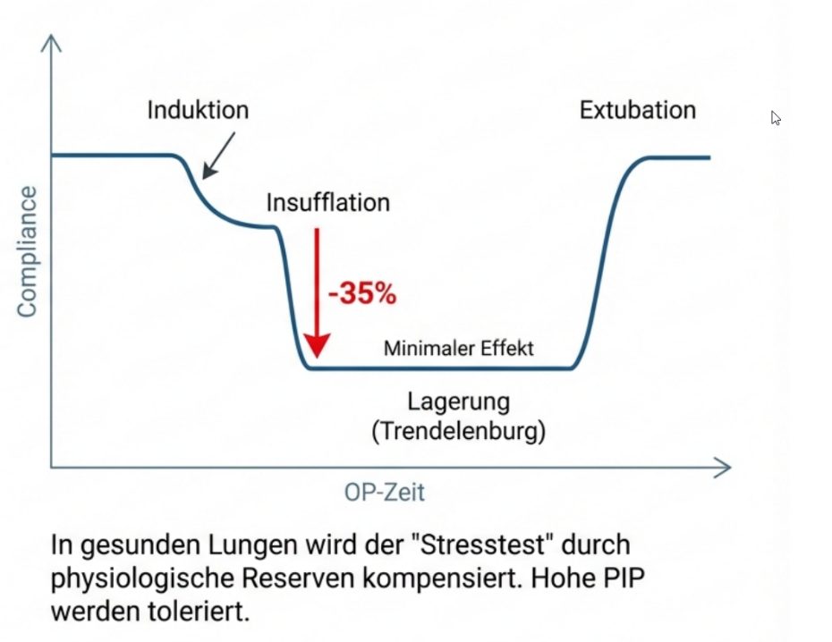 Compliance-Abfall durch Narkoseeinleitung